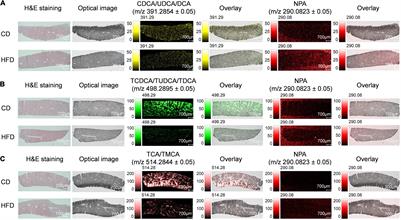 Identification and Spatial Visualization of Dysregulated Bile Acid Metabolism in High-Fat Diet-Fed Mice by Mass Spectral Imaging